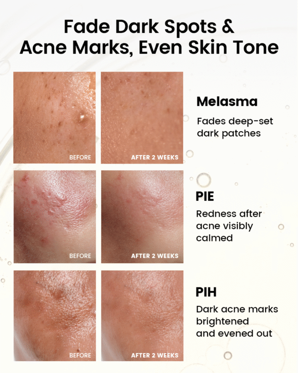 Alra_radiance_recovery_set_Fade_dark_spots_Acne_marks_even_skin_Tone